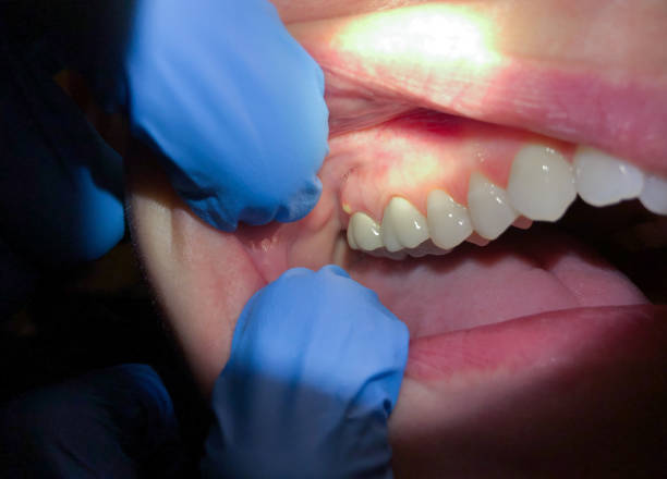 Best Emergency Treatment for Toothache in Stuart, IA